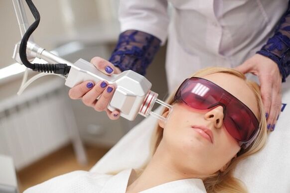 Laser aurpegiaren gaztetzea