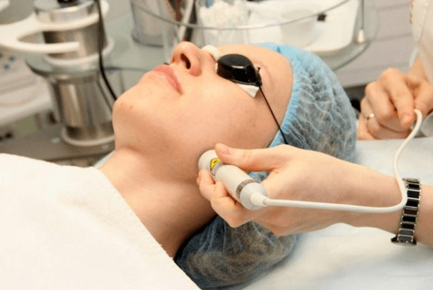 Laser Biorevitalizazioa